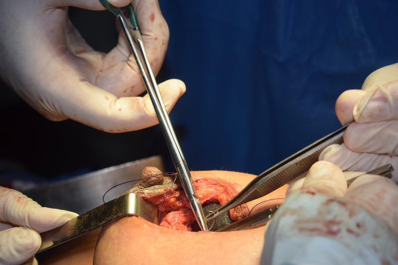 Celeb Plastic Surgery Buzz